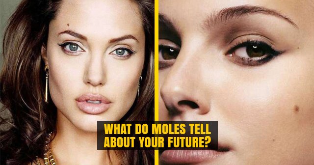 Moles on different Parts of Body