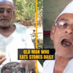 Man who eats 250 Grams of Stones